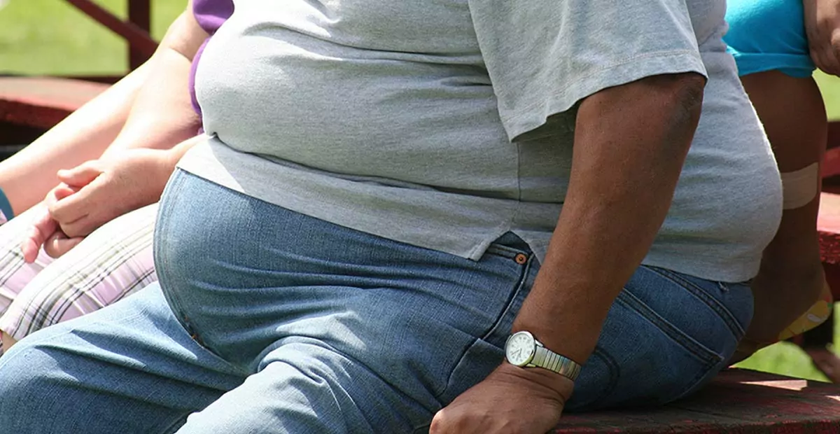 obese person